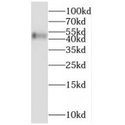 WB analysis of SH-SY5Y cells, using MCHR1 antibody (1/1000 dilution).