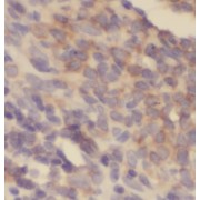 IHC-P analysis of human spleen tissue, using MCL1L-specific antibody (1/50 dilution).