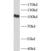 WB analysis of HepG2 cells, using MCM10 antibody (1/300 dilution).