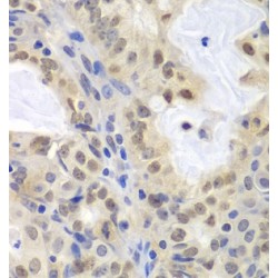 Minichromosome Maintenance Deficient 3 (MCM3) Antibody