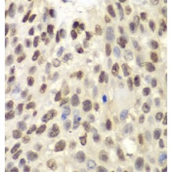 Minichromosome Maintenance Deficient 6 Homolog (MCM6) Antibody