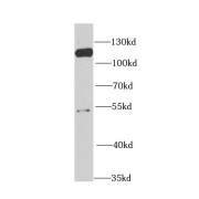 WB analysis of mouse testis tissue, using MCM6 antibody (1/1000 dilution).