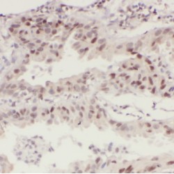 Minichromosome Maintenance Deficient 7 (MCM7) Antibody