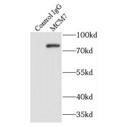 Minichromosome Maintenance Deficient 7 (MCM7) Antibody