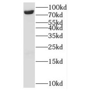 WB analysis of NIH/3T3 cells, using MCM7 antibody (1/3000 dilution).