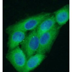 C-C Motif Chemokine 2 / MCP1 (CCL2) Antibody