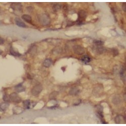 C-C Motif Chemokine 2 / MCP1 (CCL2) Antibody