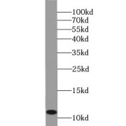 WB analysis of HeLa cells, using MCP1 antibody (1/300 dilution).