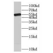 WB analysis of Jurkat cells, using MCRS1 antibody (1/1000 dilution).