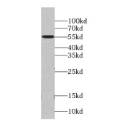 WB analysis of SKOV-3 cells, using MCRS1 antibody (1/1000 dilution).