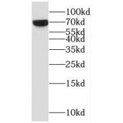 WB analysis of U-937 cells, using MCSF antibody (1/200 dilution).