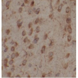 Multiple C2 And Transmembrane Domain Containing 2 (MCTP2) Antibody