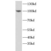 WB analysis of mouse liver tissue, using MCTP2 antibody (1/500 dilution).