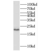 WB analysis of mouse bladder tissue, using MCTS1 antibody (1/600 dilution).