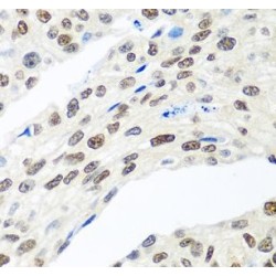 Mediator Of DNA Damage Checkpoint 1 (MDC1) Antibody