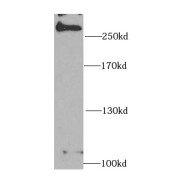 WB analysis of HeLa cells, using MDC1 antibody (1/1000 dilution).