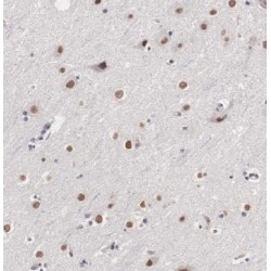 Mdm1 Nuclear Protein (MDM1) Antibody