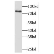 WB analysis of Raji cells, using MDM1 antibody (1/500 dilution).