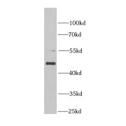 WB analysis of HT-29 cells, using MDM2 antibody (1/1000 dilution).