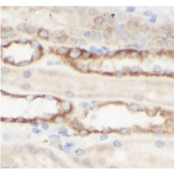 Malic Enzyme 2, NADP+ Dependent, Mitochondrial (ME2) Antibody