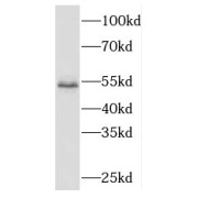 WB analysis of K-562 cells, using ME2 antibody (1/600 dilution).