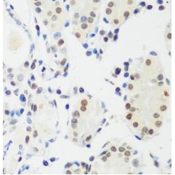 Methyl-CpG Binding Protein 2 (MECP2) Antibody