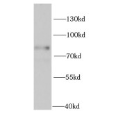 WB analysis of MDA-MB-453s cells, using MECP2 antibody (1/1000 dilution).