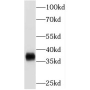 WB analysis of mouse heart tissue, using MECR antibody (1/500 dilution).