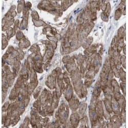 Trans-2-Enoyl-CoA Reductase, Mitochondrial (Mecr) Antibody