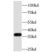 WB analysis of mouse heart tissue, using MECR antibody (1/500 dilution).