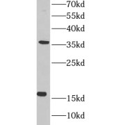 WB analysis of COLO320 cells, using MED10 Antibody (1/500 dilution).