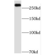 WB analysis of mouse liver tissue, using MED12L antibody (1/500 dilution).