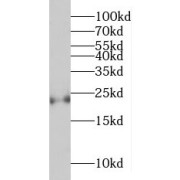 WB analysis of K562 cells, using MED20 antibody (1/1000 dilution).