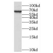 WB analysis of mouse ovary tissue, using MED26 antibody (1/500 dilution).