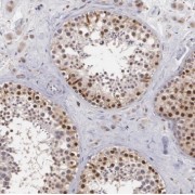 IHC-P analysis of human testis tissue, using MED28 Antibody (1/50 dilution).