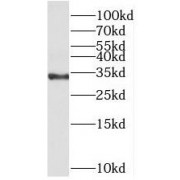 WB analysis of A431 cells, using MED6 antibody (1/1000 dilution).