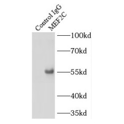 Myocyte-Specific Enhancer Factor 2C (MEF2C) Antibody
