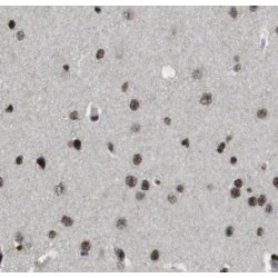 Myocyte-Specific Enhancer Factor 2C (MEF2C) Antibody