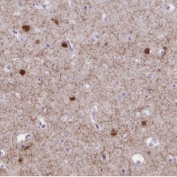 Myocyte-Specific Enhancer Factor 2C (MEF2C) Antibody