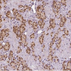 Meis Homeobox 2 (MEIS2) Antibody