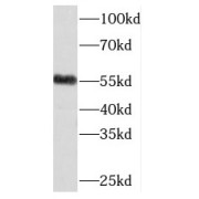 WB analysis of Jurkat cells, using MEIS2 antibody (1/500 dilution).