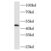 WB analysis of mouse liver tissue, using MEIS3 antibody (1/800 dilution).