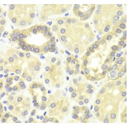 Dual Specificity Mitogen-Activated Protein Kinase Kinase 2 (MEK2) Antibody