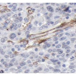 Dual Specificity Mitogen-Activated Protein Kinase Kinase 4 (MEK4) Antibody