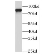 WB analysis of mouse kidney tissue, using MEP1A antibody (1/1000 dilution).