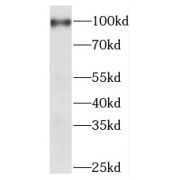 WB analysis of HeLa cells, using MEPE antibody (1/1500 dilution).