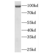 WB analysis of HeLa cells, using MEPE antibody (1/1500 dilution).