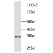 WB analysis of human testis tissue, using MEST antibody (1/500 dilution).