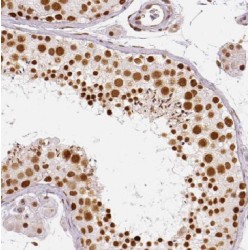 Methionine Aminopeptidase 2 (METAP2) Antibody