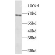 WB analysis of HepG2 cells, using METAP2 antibody (1/300 dilution).